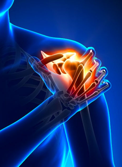 Arthrose Syndrome canalaire Fractures Arthroscopie du poignet